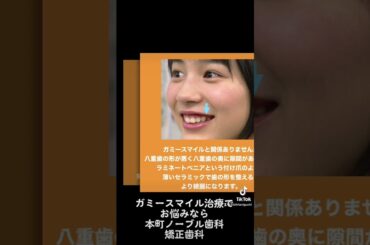 有名人のガミースマイル治療〜能年玲奈（のん）編〜