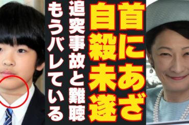 【悠仁さま首に傷と車追突は難聴で病院】秋篠宮さま私的な新年会で被災地より献上心配に爆笑！紀子様とメディア隠蔽！安倍派幹部の立件断念で麻生太郎vs岸田首相！松本人志が選挙の可能性