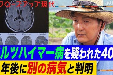 【患者数400万人以上】なぜ認知症には”誤診”が多いのか？アルツハイマー病やレビー小体型認知症などの特徴やうつ病との類似点とは？専門医が監修したチェックリストも(語り:安元洋貴)【クロ現】| NHK